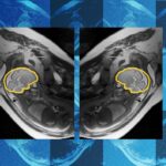 Why teaching AI about symmetry could make prenatal diagnosis more reliable | MIT News